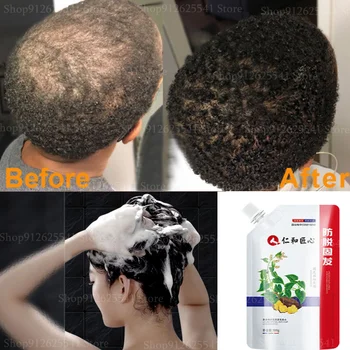 300ml Anti Hair Loss Shampoo Polygonum Multiflorum Juuksed Kasvu Šampoonid Paksendaja Remont Kahju Taastada Juuste hooldusvahendid